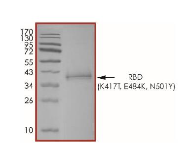 The purity of 2019-nCoV Spike protein S1 subunit, RBD (K417T, E484K and N501Y) was determined to be >90% by densitometry